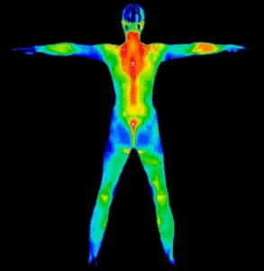 medical thermography Langley Chilliwack New Westminster Breast Screening